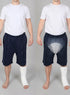 ComfortCure Adaptive Pflegeshorts für bettlägerige Patienten - Klettverschluss, vorne komplett zu öffnen, Navy, Vergleich Vorderansicht mit Gips und transparenter Vorlage