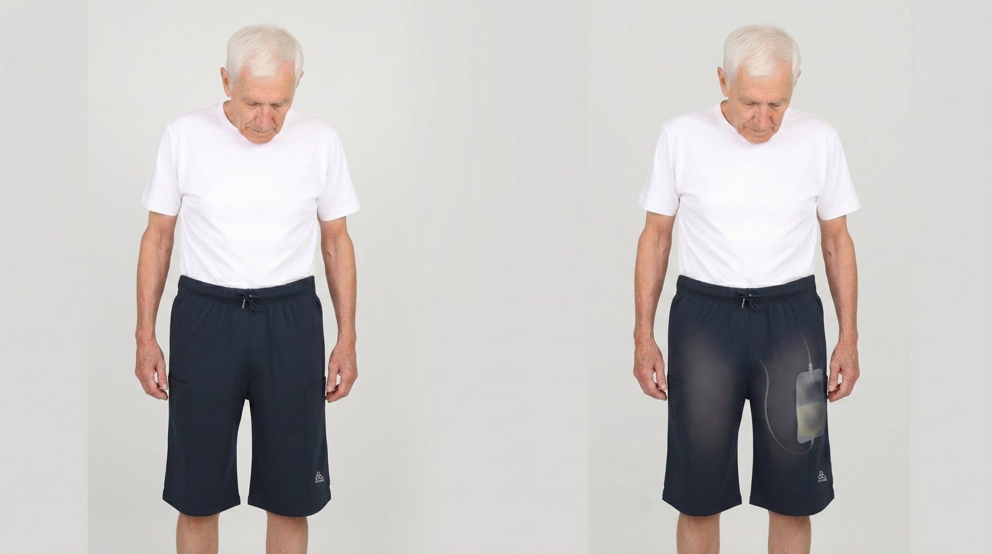 ComfortCure Adaptive Pflegeshorts für Prostatapatienten (mit Beintaschen), Schwarz, zweiteilige Vorderansicht, rechts mit transparentem Urinbeutel in der Beintasche