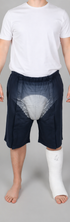 ComfortCure Adaptive Pflegeshorts für bettlägerige Patienten - Klettverschluss, vorne komplett zu öffnen, Navy, Vorderansicht mit transparenter Vorlage, Gips am Bein