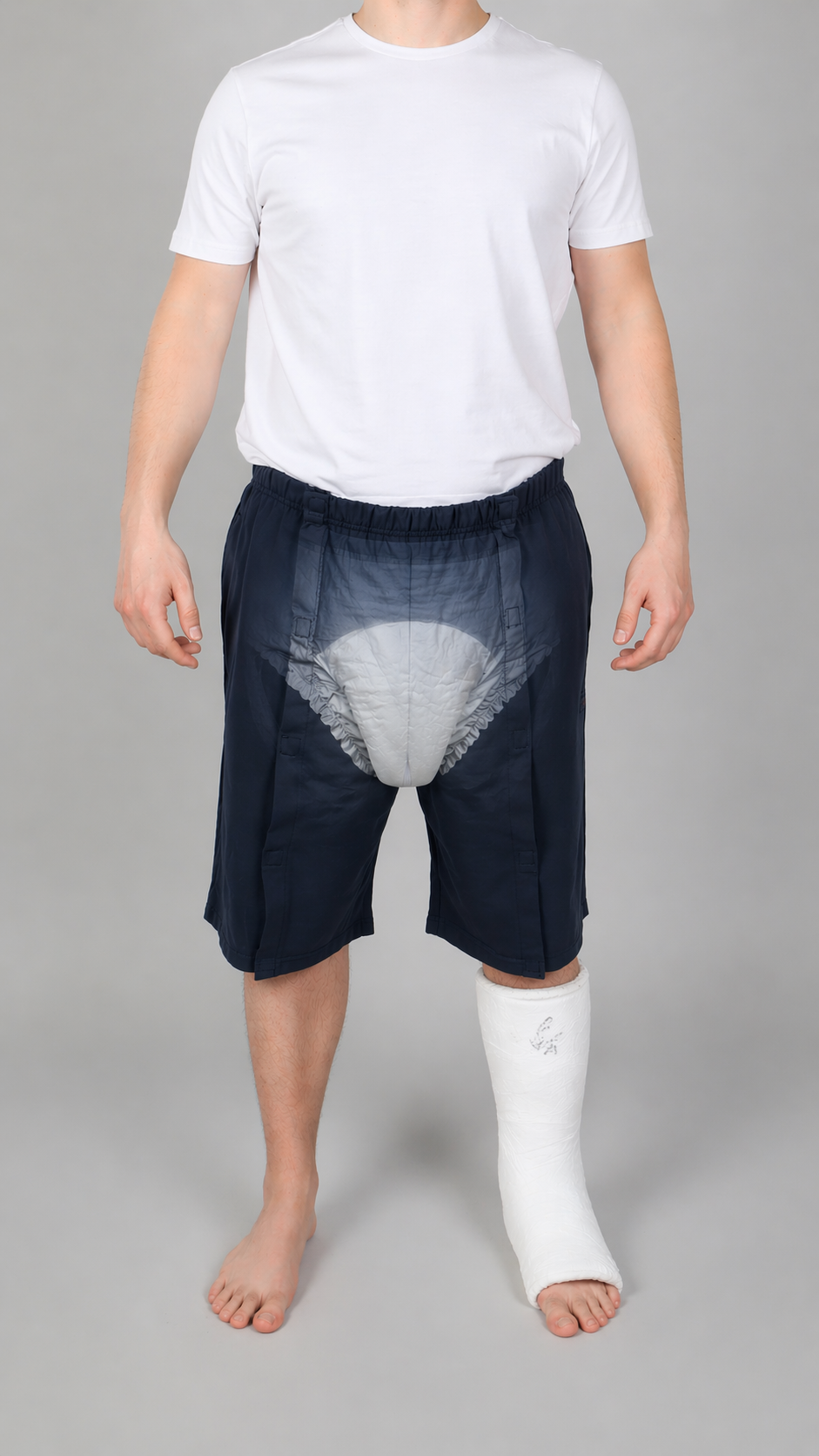 ComfortCure Adaptive Pflegeshorts für bettlägerige Patienten - Klettverschluss, vorne komplett zu öffnen, Navy, Vorderansicht mit transparenter Vorlage, Gips am Bein